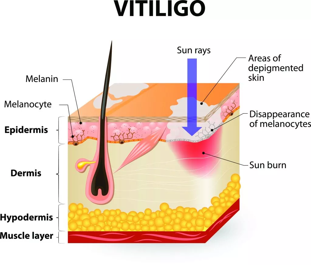 Light Therapy Lamp 4