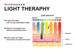 phototherapy for skin disorders